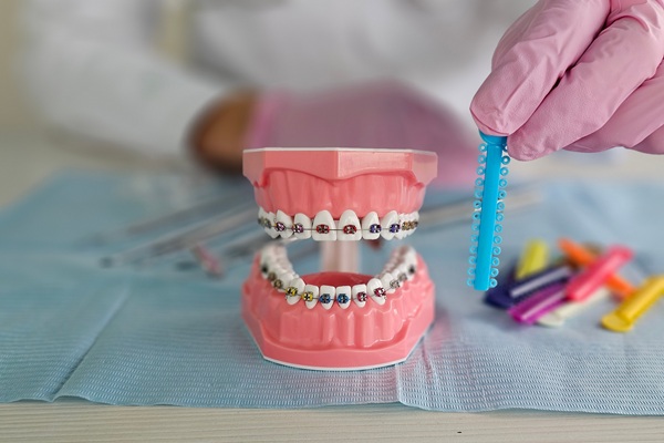 How A Braces Specialist Can Streamline Teeth Straightening